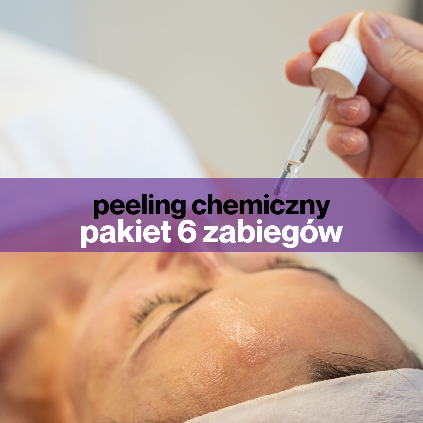Pakiet 6 zabiegów - peelingów chemicznych